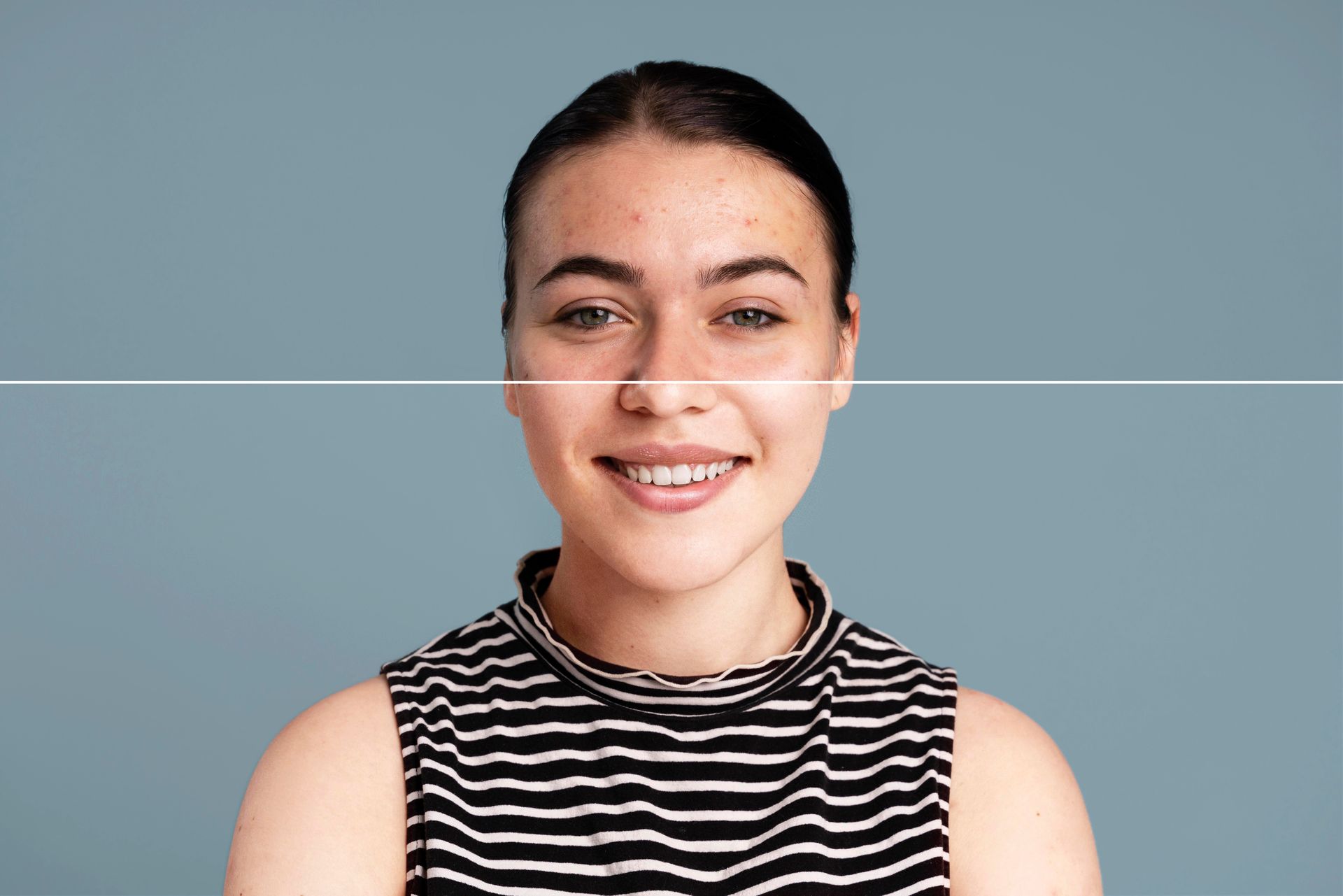 Estos son los imperdibles tratamientos para el rejuvenecimiento facial
