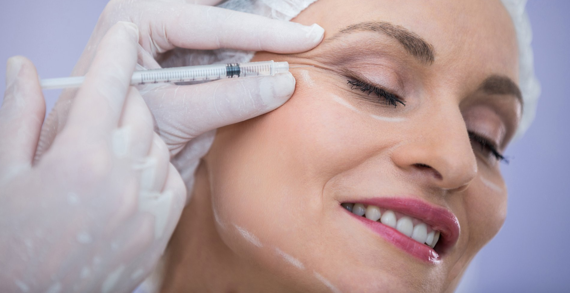 ¿Para qué se utiliza la toxina botulínica? Aquí te lo contamos