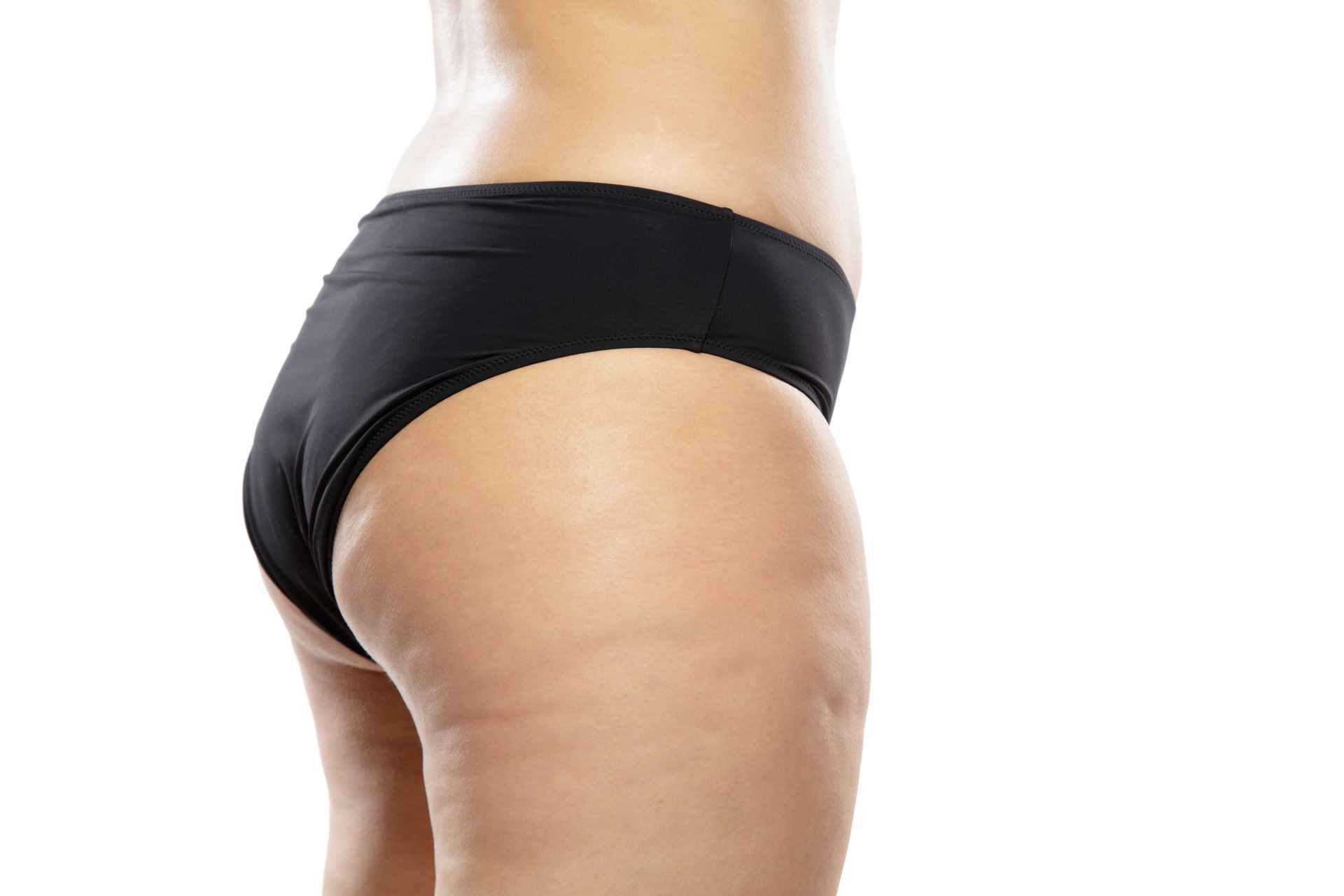 ¿Cómo quitar la celulitis? te tenemos la respuesta a esta pregunta