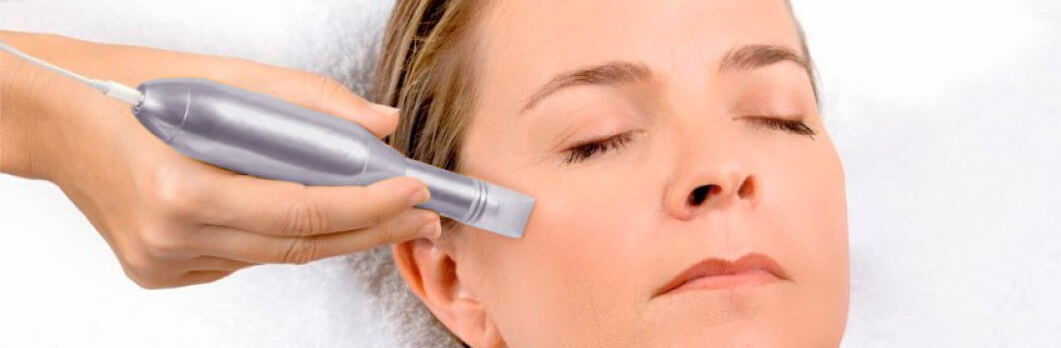 ¿Qué es el microneedling? Regenera tu piel y evita la caída de cabello